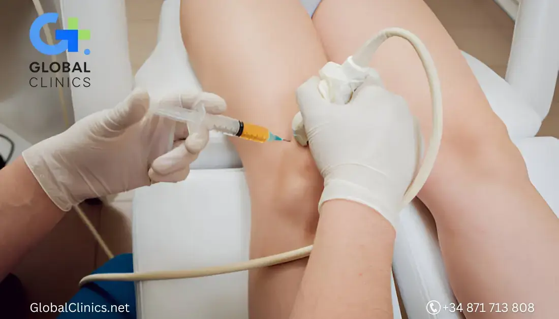 Aplicación de PRP ecoguiado en rodilla mediante ecografía médica de alta precisión en Global Clinics Palma.
