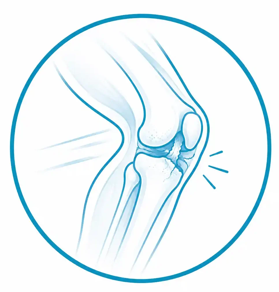 Lesiones deportivas en traumatología