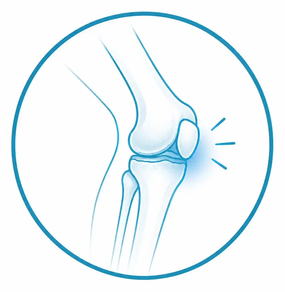 Dolor de rodilla en traumatología